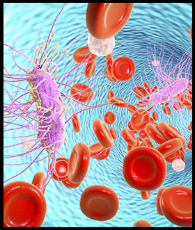 Learn about Sepsis